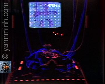 Media000Install